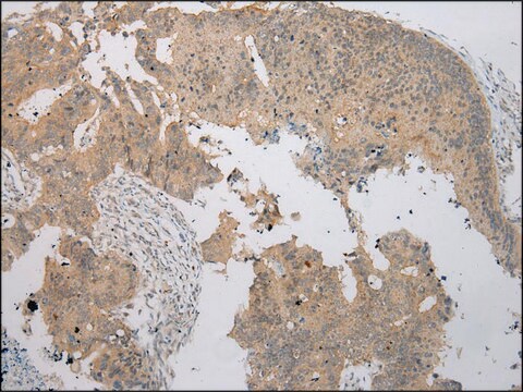 Anti-NUDT6 affinity isolated antibody