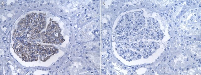 Anti-&#945;-Actinin 4 Antibody, clone 1D9 ZooMAb&#174; Rabbit Monoclonal recombinant, expressed in HEK 293 cells