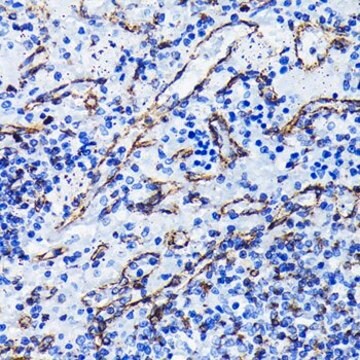 Anti- Vimentin antibody produced in rabbit