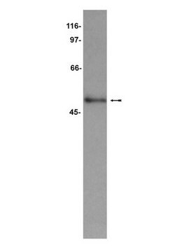 Anti-CUGBP1 Antibody, clone 3B1 clone 3B1, Upstate&#174;, from mouse