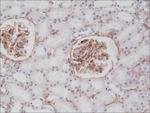 Anti-CD140b (PDGF Receptor beta)antibody, Rabbit Monoclonal recombinant, expressed in HEK 293 cells, clone RM303, purified immunoglobulin