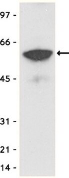 Anticuerpo anti-etiqueta Myc, clon 4A6, conjugado con agarosa clone 4A6, Upstate&#174;, from mouse