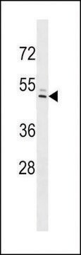 ANTI-IFI44L(C-TERMINAL) antibody produced in rabbit affinity isolated antibody, buffered aqueous solution