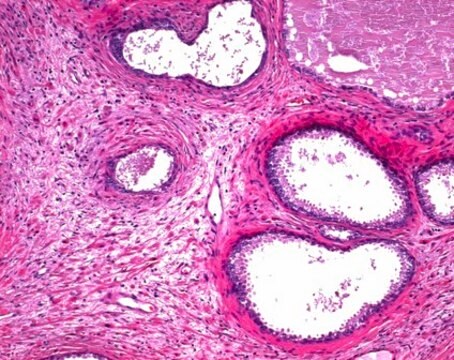 Eosin Y-Lösung, 1&nbsp;%, alkoholisch for microscopy