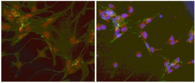 Anticorpo anti-proteina 1 specifica dei fibroblasti (S100A4) from rabbit, purified by affinity chromatography