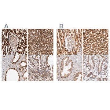 Anti-ATP5B antibody produced in rabbit Ab2, Prestige Antibodies&#174; Powered by Atlas Antibodies, affinity isolated antibody, buffered aqueous glycerol solution