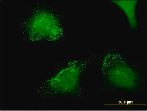 Monoclonal Anti-ACP5 antibody produced in mouse clone 2D9, purified immunoglobulin, buffered aqueous solution