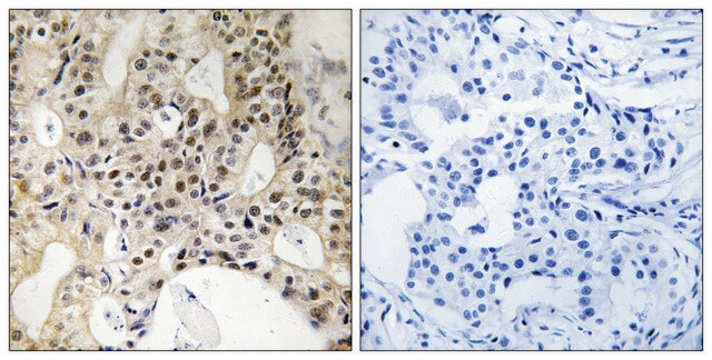 Anti-LATS1 antibody produced in rabbit affinity isolated antibody