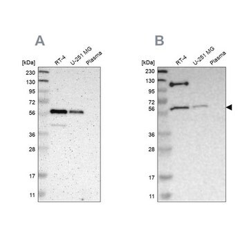 Anti-TRAF2 antibody produced in rabbit Ab1, Prestige Antibodies&#174; Powered by Atlas Antibodies, affinity isolated antibody, buffered aqueous glycerol solution