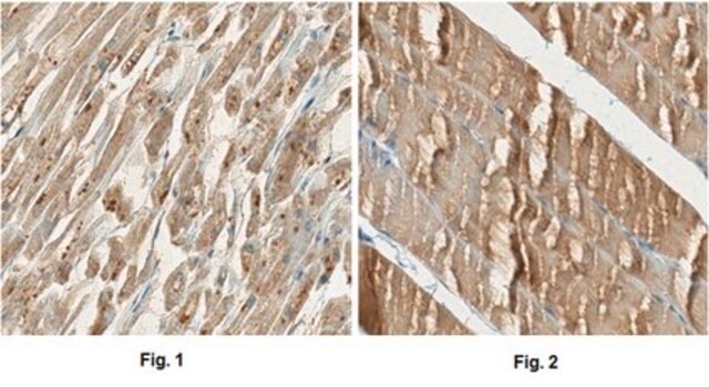 Anti-Cav1.1 alpha1s Antibody, clone 1A, Ascites Free clone 1A, from mouse