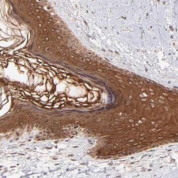 Anti-TNRC6B antibody produced in rabbit Prestige Antibodies&#174; Powered by Atlas Antibodies, affinity isolated antibody, buffered aqueous glycerol solution