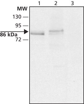 Anti-DYRK1A (N-terminal) antibody produced in rabbit ~1.5&#160;mg/mL, affinity isolated antibody, buffered aqueous solution