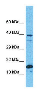 Anti-RPS19 (C-terminal) antibody produced in rabbit affinity isolated antibody