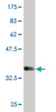 Monoclonal Anti-LSM1, (C-terminal) antibody produced in mouse clone 4F7, purified immunoglobulin, buffered aqueous solution