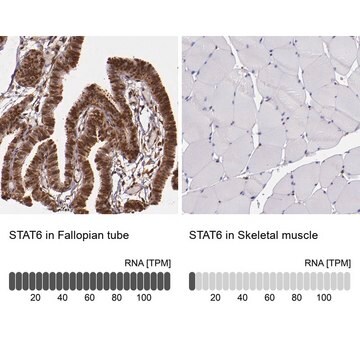 抗STAT6 ウサギ宿主抗体 affinity isolated antibody, buffered aqueous glycerol solution