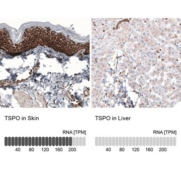 Przeciwciało anty-TSPO wytwarzane u myszy Prestige Antibodies&#174; Powered by Atlas Antibodies, clone CL13359, purified by using Protein A, buffered aqueous glycerol solution