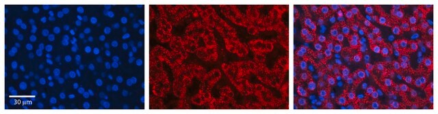 抗HADH抗体 ウサギ宿主抗体 affinity isolated antibody