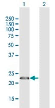 Anti-CENPN antibody produced in rabbit purified immunoglobulin, buffered aqueous solution