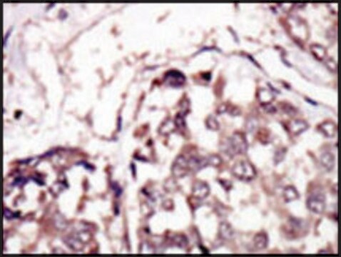 Anti-RYK (C-term) antibody produced in rabbit IgG fraction of antiserum, buffered aqueous solution