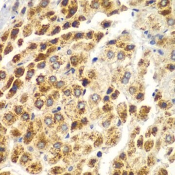 Anti- SND1 antibody produced in rabbit