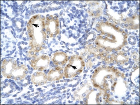 Anti-TBX1 IgG fraction of antiserum