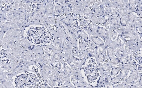 抗CD34抗体 クローン5C15 ZooMAb&#174; ウサギ・モノクローナル recombinant, expressed in HEK 293 cells