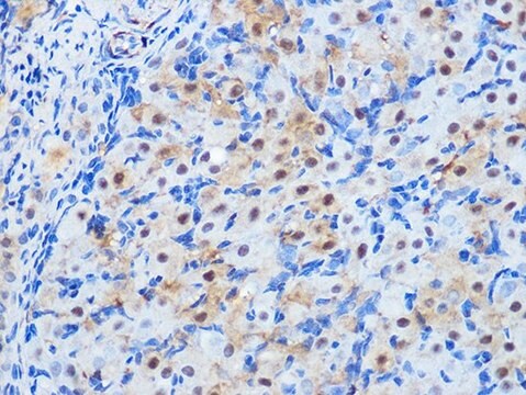 Anti-PP1 beta antibody produced in rabbit