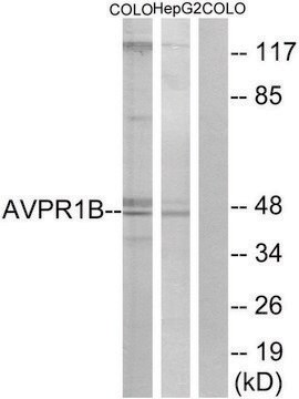 Anti-AVPR1B antibody produced in rabbit affinity isolated antibody