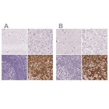 Anty-PRL Prestige Antibodies&#174; Powered by Atlas Antibodies, affinity isolated antibody