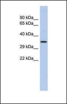 Anti-PRDM12, (N-terminal) antibody produced in rabbit affinity isolated antibody