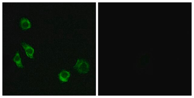 Anti-GPRC5D antibody produced in rabbit affinity isolated antibody