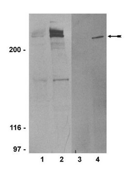 Anti-Phospho-ATM(Ser1981)-Antikörper, Klon 10H11.E12 clone 10H11.E12, Upstate&#174;, from mouse