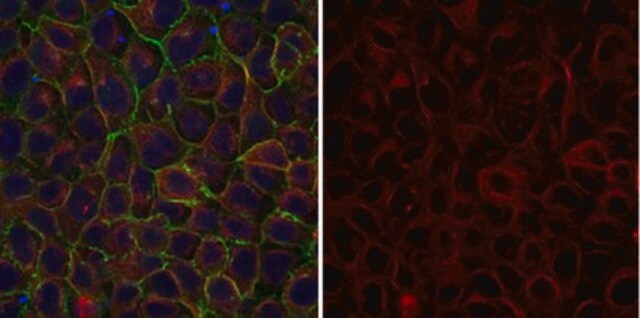 Przeciwciało anty-α-tubulina, klon DM1A, koniugat Alexa &#8482; 555 clone DM1A, from mouse, ALEXA FLUOR&#8482; 555