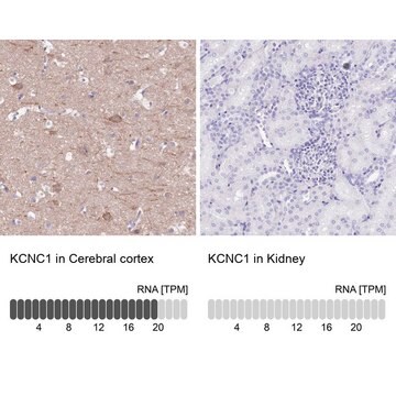 Anti-KCNC1 antibody produced in rabbit Prestige Antibodies&#174; Powered by Atlas Antibodies, affinity isolated antibody, buffered aqueous glycerol solution