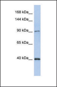 Anti-POLK antibody produced in rabbit affinity isolated antibody