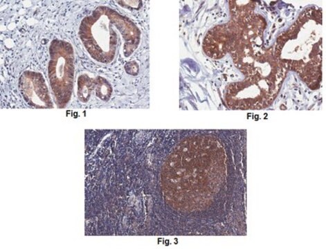 Anti-Pan Shc Antibody, clone 3A12.1 clone 3A12.1, from mouse