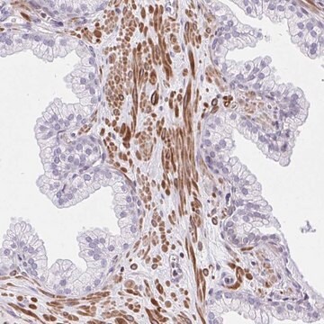 Anti-KCNN4 antibody produced in rabbit Prestige Antibodies&#174; Powered by Atlas Antibodies, affinity isolated antibody, buffered aqueous glycerol solution