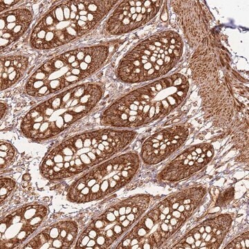 Anti-MRPS6 antibody produced in rabbit Prestige Antibodies&#174; Powered by Atlas Antibodies, affinity isolated antibody, buffered aqueous glycerol solution