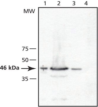 抗TSG101(N末端)抗体 ウサギ宿主抗体 ~1&#160;mg/mL, affinity isolated antibody, buffered aqueous solution