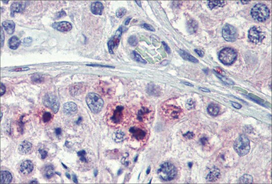 Anti-STAT5B (ab2) antibody produced in rabbit affinity isolated antibody