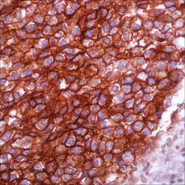 Podoplanin (D2-40) Mouse Monoclonal Antibody clone D2-40, unconjugated, Cell Marque&#8482;