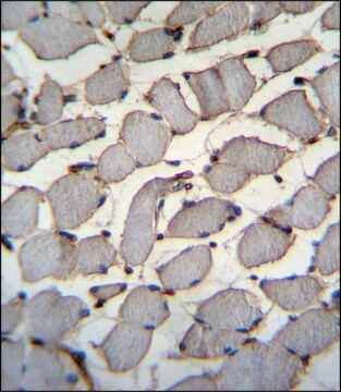 ANTI-DDX60L (C-TERM) antibody produced in rabbit IgG fraction of antiserum, buffered aqueous solution