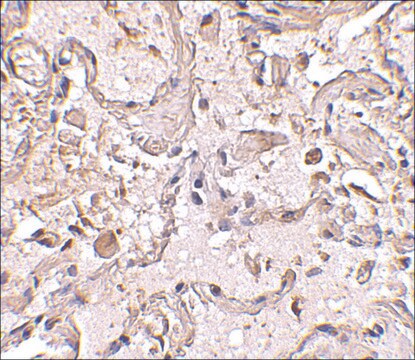 Anti-GSTP1 antibody produced in rabbit affinity isolated antibody, buffered aqueous solution