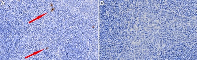 Anti-CD83 Antibody, clone 1I15 ZooMAb&#174; Rabbit Monoclonal recombinant, expressed in HEK 293 cells