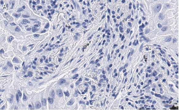 抗uPAR抗体 クローン2G10 ZooMAb&#174; ウサギ・モノクローナル recombinant, expressed in HEK 293 cells