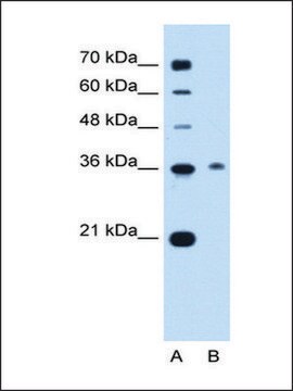 Anti-C11ORF54 (AB2) antibody produced in rabbit affinity isolated antibody