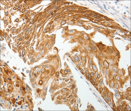 Anty-TMSB10 affinity isolated antibody