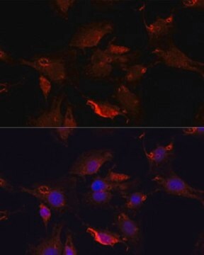 Anti-TYMS antibody produced in rabbit