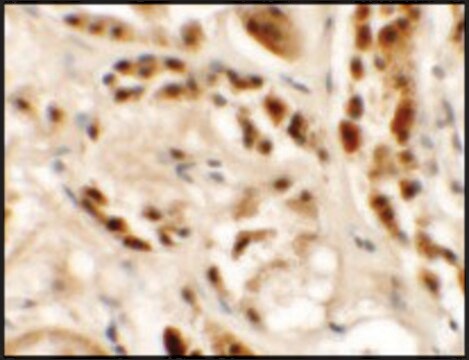 抗 SIGLEC15 兔抗 affinity isolated antibody