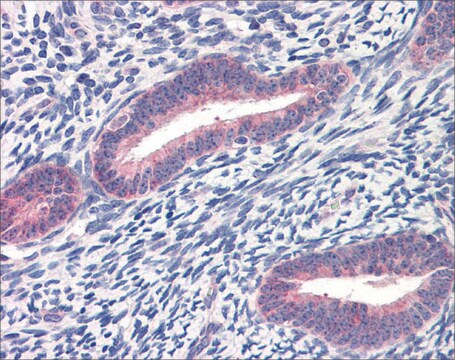 抗TWIST1 IgG fraction of antiserum